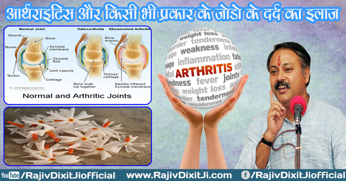 28. Miraculous Treatment of Arthritis Knee Joint Pain Fever Pain By