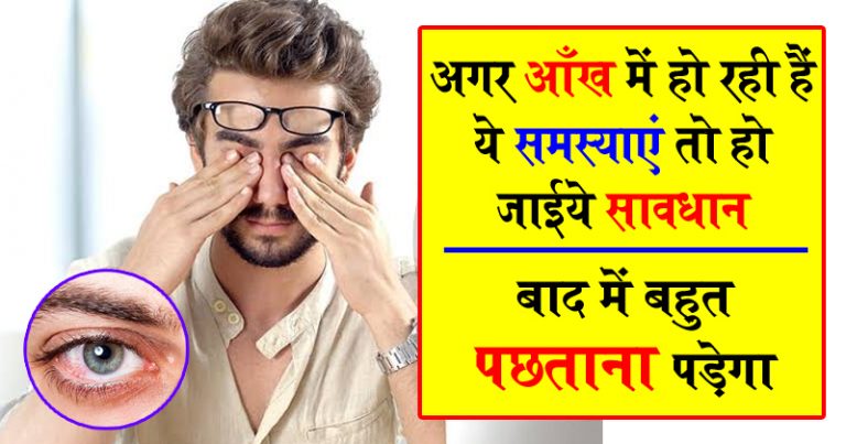 अगर आँख में हो रही हैं ये समस्याएं तो हो जाईये सावधान, बाद में बहुत पछताना पड़ेगा अगर आँख में हो रही हैं ये समस्याएं तो हो जाईये सावधान, बाद में बहुत पछताना पड़ेगा