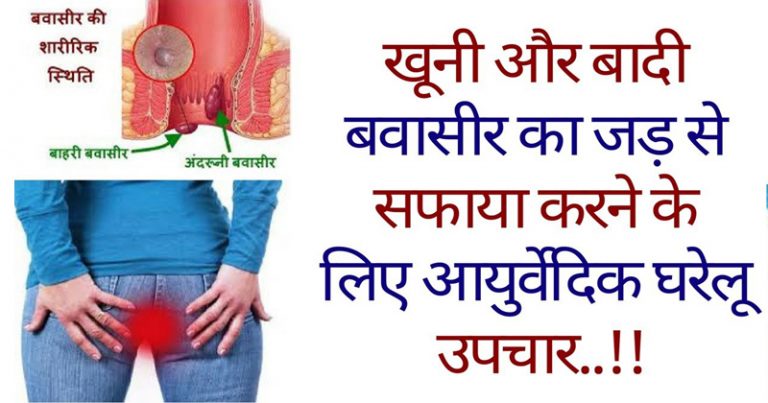 जानिए बवासीर को जड़ से खत्म करने के आयुर्वेदिक उपचार जानिए बवासीर को जड़ से खत्म करने के आयुर्वेदिक उपचार