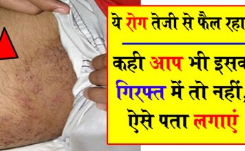 तेजी से फ़ैल रहा है ये रोग ! कही आप भी इसकी गिरफ्त में तो नहीं, ऐसे पता लगाएं
